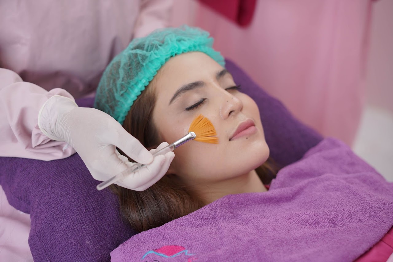 chemical peeling wajah terbaik